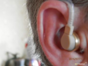 В ухе искажение звуков