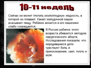 Аборт на 11 неделе