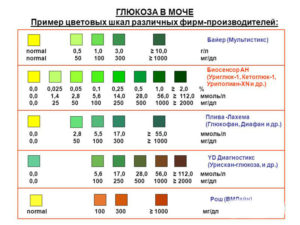 Глюкоза в моче 28! Сахарная кривая норма или нет?
