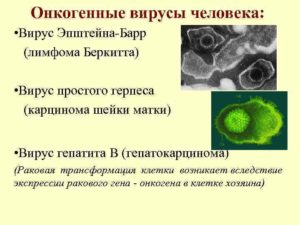 Не помогает лечение против вируса Эпштейн Барр