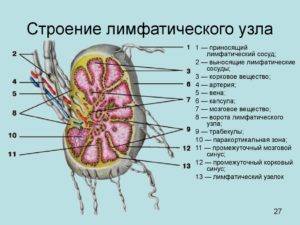 Лимфоузел структурно измененный