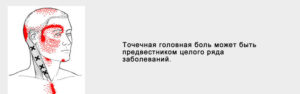 Боль в одной точке головы