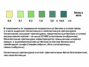 Белок в моче 0,2 без симптомов