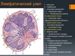 Лимфоузел структурно измененный