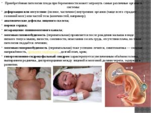 Осложнения беременности и пороки развития плода по генетическому анализу