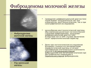 Фиброаденома или гиперплазия?
