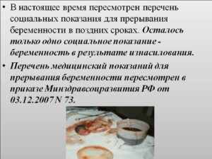 Прерывание беременности на позднем сроке
