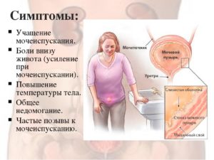 Сильно болит низ живота при месячных больно ходить в тулет