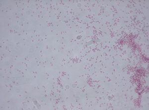 Обнаружили в зеве enterobacter aerogenes