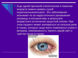 Слезится глаз с внешней стороны