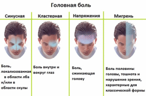 Не проходит головная боль