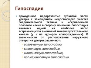 Гипоспадия