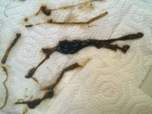 Вместо месячных пошла небольшая слизь с кровянистыми прожилками