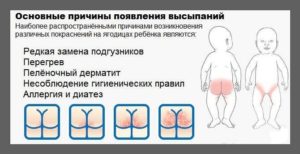 Очень сильное покраснение в паху у грудничка