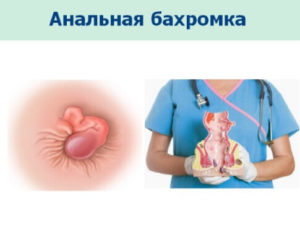 Удалила анальную бахромку