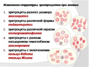 Анизоцитоз у ребенка