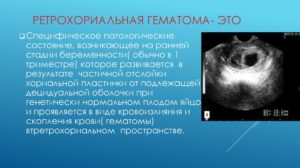 Ретрохориальная гематома и выделения