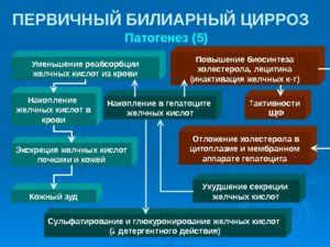Первичный билиарный цирроз