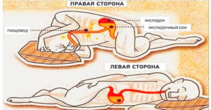 Не могу лежать на левом боку