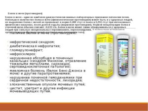 Белок в моче 0,2 без симптомов