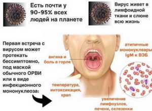 Вэб в зеве у ребенка