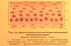 U - Эпителий плоский поверхностного слоя 10-15 в п/зр