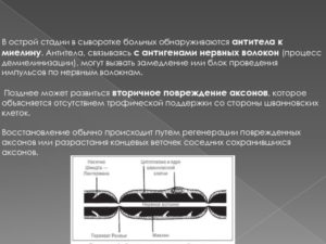 Антитела к антигену миелина