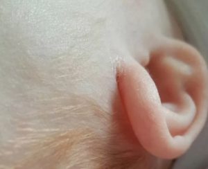 Трещина за ухом