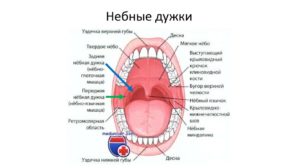 Белые пятна на небных дужках