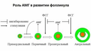 Высокий ФСГ, низкий АМГ