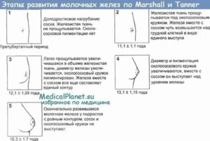 Не растет грудь в 15 лет