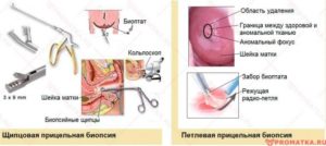 Задержка 15 дней после биопсии шейки матки