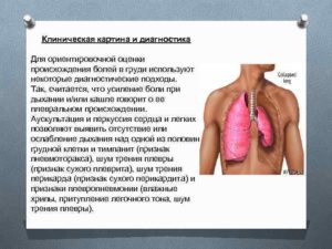 Кашель и боль под грудью слева