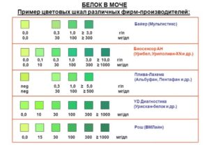 Белок в моче 0,2 без симптомов