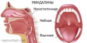 Белая точка на гланде