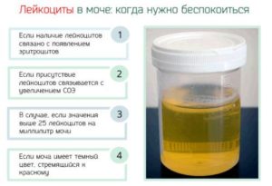 После лечения холецистита лейкоциты в моче 500