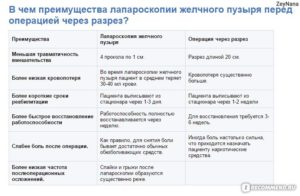 Сильное похудение после холецистэктомии