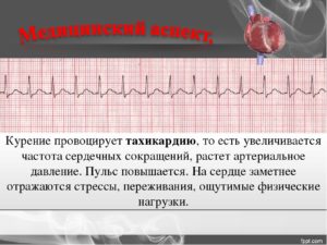 Тахикардия после курения