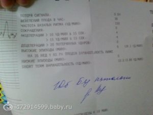 Ктг расшифровка 36 недель