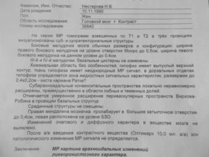 Расшифровать МРТ и по возможности поставить диагноз