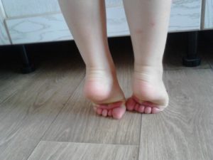 Ребёнок ходит на пальцах