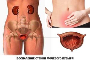 Повторная боль после первого полового акта