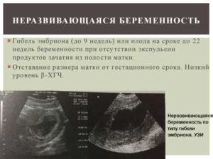 Планирование после двух неразвивающихся беременностей
