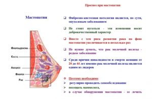 Двусторонняя фиброзная мастопатия. Кл. гр.1б