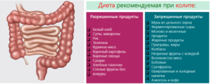 Запоры, долихосигма и срк, как мне быть?