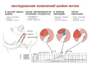 Шейка матки очень низко, прозрачные выделения, тянет низ живота сильно