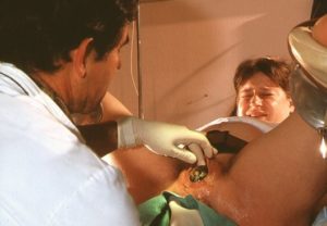 После зашивания влагалища врачом, практикантка засунула руку