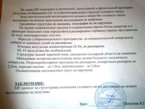 Расшифровать МРТ и по возможности поставить диагноз