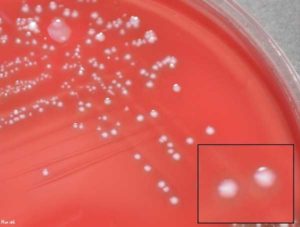 Лечение Streptococcus agalactiae 10 в 6