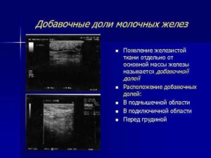 Добавочная доля молочной железы